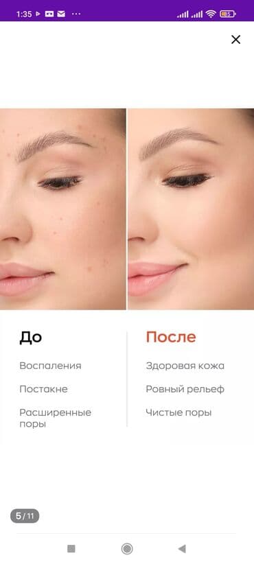 эко спрей от вшей как пользоваться: Энзимная пудра Likato Ликато– отличный вариант для людей с — 15