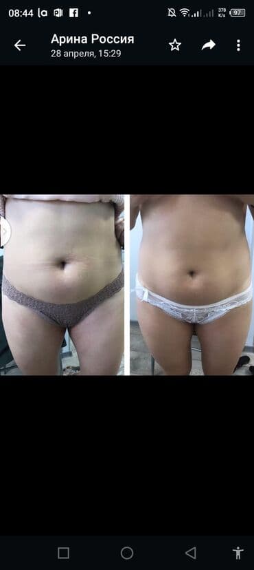 самый лучший эндокринолог рядом просп жибек жолу бишкек: Косметология, Ботокс, Восстановление объема губ, Лифтинг нити, С выездом на дом, Консультация, Гипоаллергенные материалы — 8