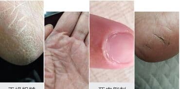 личный кабинет эрсаг кыргызстан: 🔥 Заживитель трещин . Шикарное средство — 4