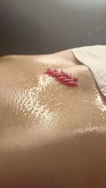 m ms: Косметология, Консультация, Гипоаллергенные материалы — 1