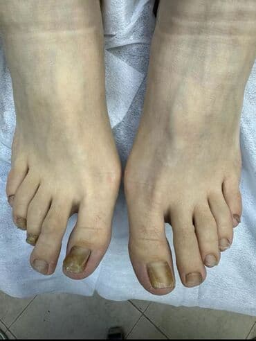 на дом керек: Услуги подолога, С выездом на дом, Консультация, Одноразовые расходные материалы — 3