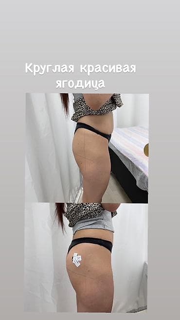 ава терапия: Коллагенотерапия и уход с экзосомами, пептидами и 8 видами коллагена — 7