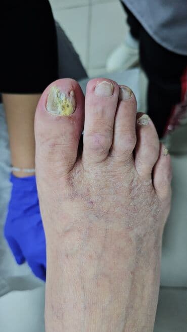 сколько стоит обучение на маникюр: Наращивание ногтей, Гель лак, шеллак, Укрепление ногтей, Услуги подолога, Маникюр, Педикюр, Консультация, Одноразовые расходные материалы — 4