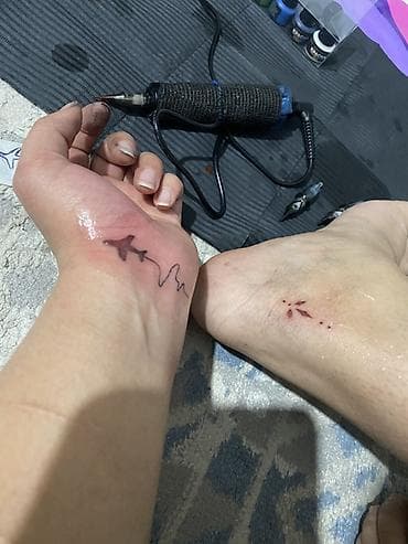 Массаж: Ак кара татуировкалар | Консультация — 2