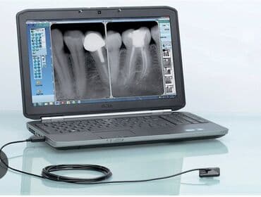 продажа медицинского оборудования: Визиографы - в наличии самый большой выбор. Лучшие оригинальные — 1