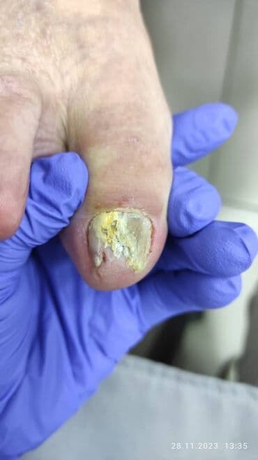 сколько стоит обучение на маникюр: Наращивание ногтей, Гель лак, шеллак, Укрепление ногтей, Услуги подолога, Маникюр, Педикюр, Консультация, Одноразовые расходные материалы — 1