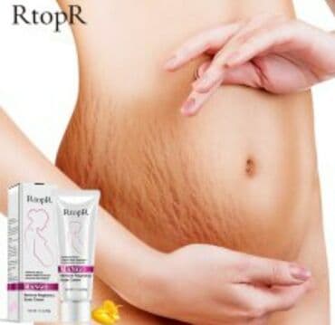 растяжки: Крем от растяжек при беременности с экстрактом Манго  RtopR. Крем от — 2
