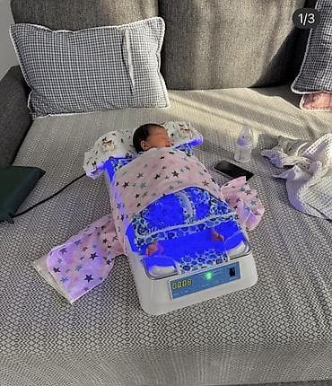 Медицинские лампы: Фотолампа от желтушки 👶 Аренда от --1000 сом в сутки .Консультация — 5