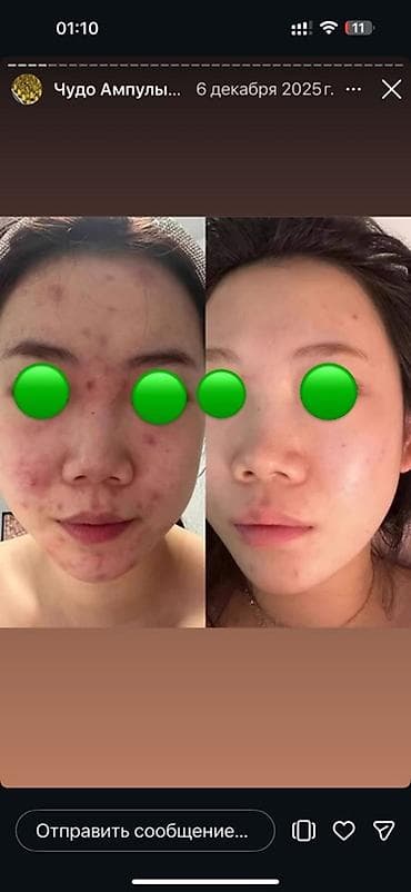 nike original: Ампулы для лица SymWhite 377 Ampoule (JUWAY) — осветляющая и — 8