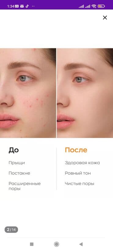 эко спрей от вшей как пользоваться: Энзимная пудра Likato Ликато– отличный вариант для людей с — 2