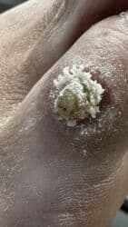 арендовать дом: Выравнивание, Услуги подолога, С выездом на дом, Консультация, Одноразовые расходные материалы — 47