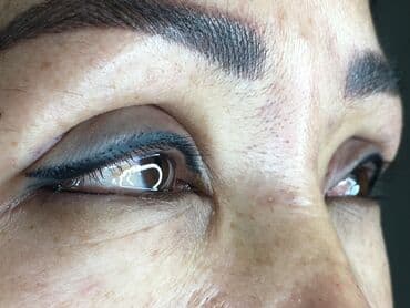 сангапури: Косметология, Маски, Биоревитализация, Ботокс, С выездом на дом, Консультация, Гипоаллергенные материалы — 5