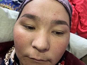 ботекс губы: Ресницы, Гипоаллергенные материалы, С выездом на дом, Требуются модели — 10