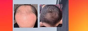 Красота и здоровье: ExtraHair Hair Care Serum — профессиональная сыворотка для ухода за — 4