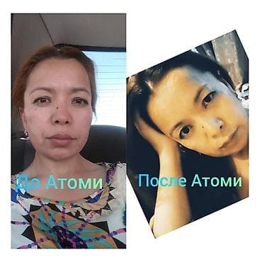 n 95: Косметология, Маски, Массаж лица, Отбеливание пигментных пятен, Консультация, Гипоаллергенные материалы, Требуются модели — 10