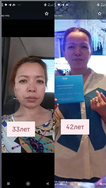 n 95: Косметология, Маски, Массаж лица, Отбеливание пигментных пятен, Консультация, Гипоаллергенные материалы, Требуются модели — 9