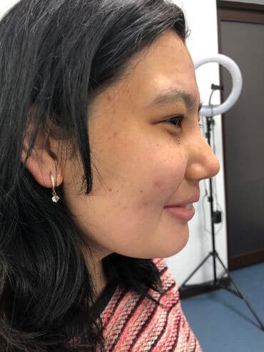 сколько стоит операция варикоцеле в бишкеке: Косметология, Лечение угревой болезни, Биоревитализация, Маски, Консультация, Сертифицированный косметолог — 2