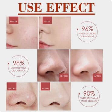 прыщей: ❄️ США СЫВОРОТКА ДЛЯ КОЖИ ОТБЕЛИВАНИЕ цена-450сом\флак-розниц — 9