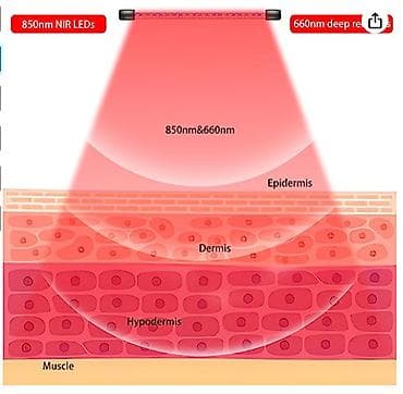 аргон для суставов: ❄️Физиотерапия для суставов и не только - инфракрасный свет для — 3