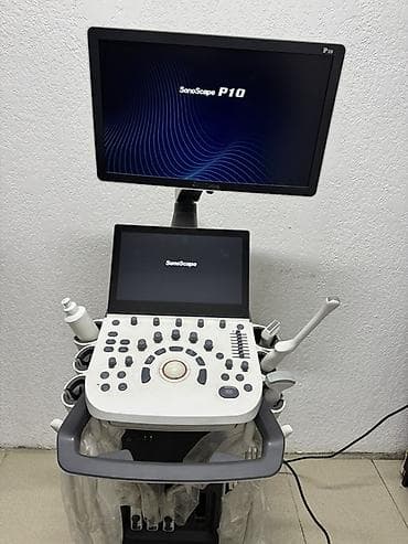 Продается УЗИ аппарат SonoScape P10 в идеальном состоянии,без