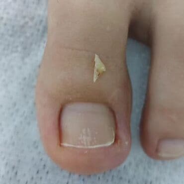 сколько стоит обучение на мастера маникюра: Коррекция вросших ногтей, Маникюр, Педикюр, Услуги подолога, Консультация, Одноразовые расходные материалы — 1