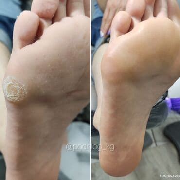 сколько стоит обучение на мастера маникюра: Коррекция вросших ногтей, Маникюр, Педикюр, Услуги подолога, Консультация — 2