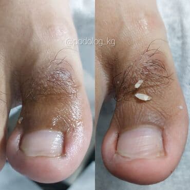 сколько стоит обучение на маникюр: Коррекция вросших ногтей, Услуги подолога, Педикюр, Одноразовые расходные материалы, Консультация — 11