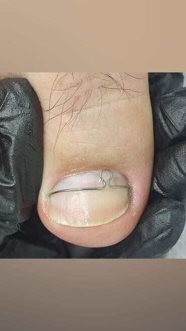 сколько стоит обучение на мастера маникюра: Коррекция вросших ногтей, Маникюр, Педикюр, Услуги подолога, Консультация, Одноразовые расходные материалы — 5