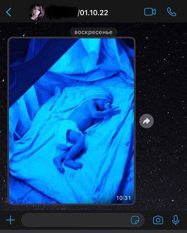 Кычкылтек концентратору: Аренда фотолампы от желтушки для новорожденных. 💛 Почему выбирают — 4