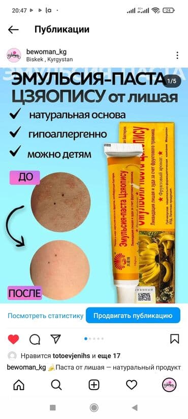 мазь король кожи купить в аптеке: Паста от лишая — натуральный продукт с целебными растительными — 1