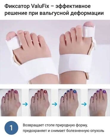 Кислородные подушки: Valufix- hallfix фиксатор от вальгусной деформации +бесплатная — 13