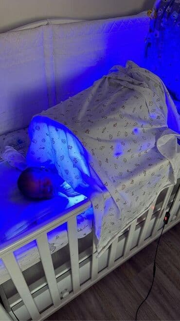 Кислородные концентраторы: Прокат Домашний фототерапевтический бокс для новорождённых — 5