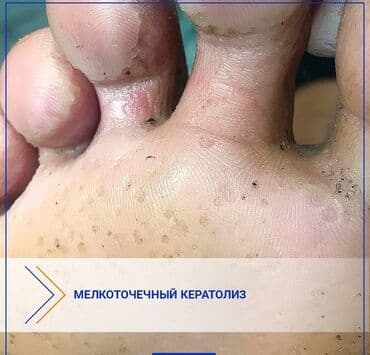 кресло барбер: Сынган тырмактарды оңдоо, Ичине кирип өскөн тырмактарды оңдоо, Педикюр, Консультация, Бир жолку сарпталуучу материалдар — 8