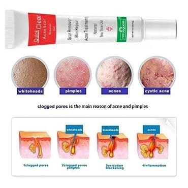 крем день и ночь китайский отзывы: Крем для лица Quick Clear с масло чайного дерева. От акне, шрамов — 3