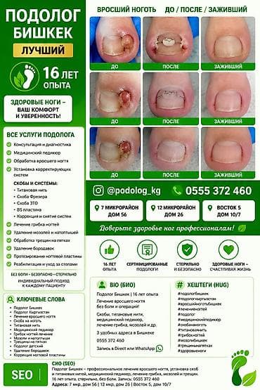 Коррекция вросших ногтей, Услуги подолога, Консультация at lalafo.kg Коррекция вросших ногтей, Услуги подолога, Консультация