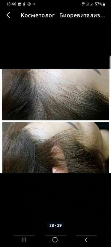 сколько стоит обучение на маникюр: Косметология, Биоревитализация, Ботулинотерапия, Сертифицированный косметолог, Гипоаллергенные материалы, Консультация — 11