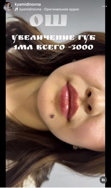 лэшмейкер обучение с трудоустройством: Косметология, Увеличение губ, Консультация — 2