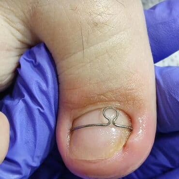 маникюр педикюр с выездом на дом: Выравнивание, Наращивание ногтей, Донаращивание ногтей, Маникюр, Педикюр, Услуги подолога, С выездом на дом, Консультация, Одноразовые расходные материалы — 2