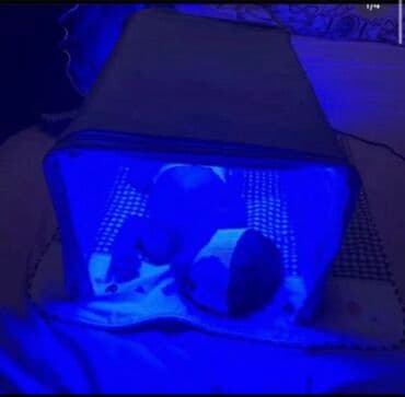 аренда лампа для лечения желтухи новорожденных: Фотолампа от желтухи !Консултация врача бесплатно !Современная — 3