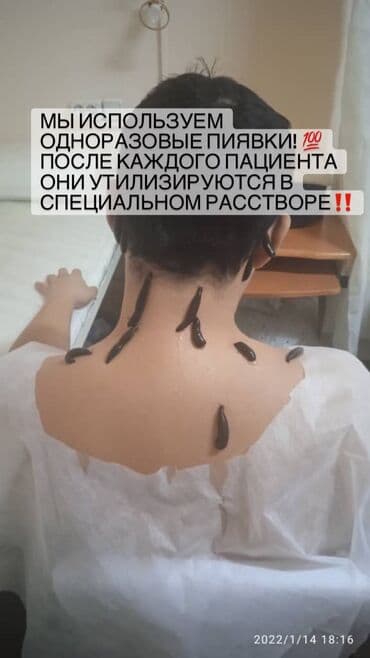 самый лучший гинеколог в бишкеке: Клиника, Дарыгерлер | Гирудотерапевт | Консультация, Диагностика, Пиявкалар менен дарылоо — 2