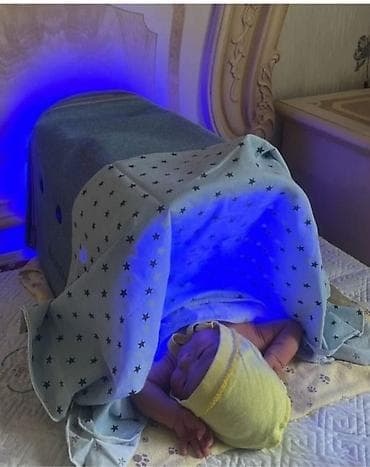 Медицинские лампы: Фотолампа для лечения желтушки у новорождённых MAINENG - — 9