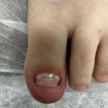 сколько стоит обучение на мастера маникюра: Коррекция вросших ногтей, Маникюр, Педикюр, Услуги подолога, Консультация, Одноразовые расходные материалы — 20