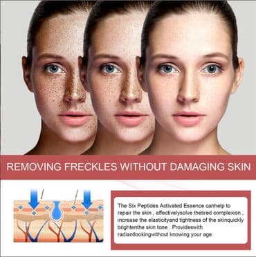 шампунь дисаар: ❄️ США Крем интенсивный отбеливающий антивозрастной с Еbay Аmazon — 12