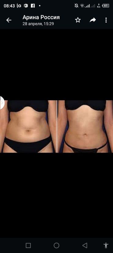 самый лучший эндокринолог рядом просп жибек жолу бишкек: Косметология, Ботокс, Восстановление объема губ, Лифтинг нити, С выездом на дом, Консультация, Гипоаллергенные материалы — 6