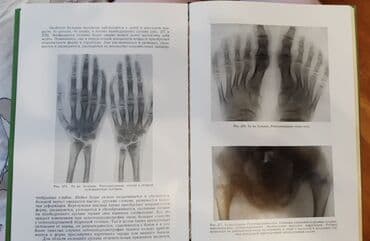 журналы об искусстве: Рейнберг С.А. Рентгенодиагностика заболеваний костей и суставов. В — 8