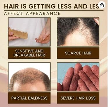 шампунь дисаар: ❄️ сша с аmazon сыворотка для лечения волос от выпадения волос от — 7