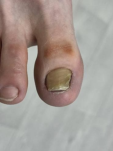 мазоли: Выравнивание, Укрепление ногтей, Ремонт сломаных ногтей, Педикюр, Одноразовые расходные материалы — 3