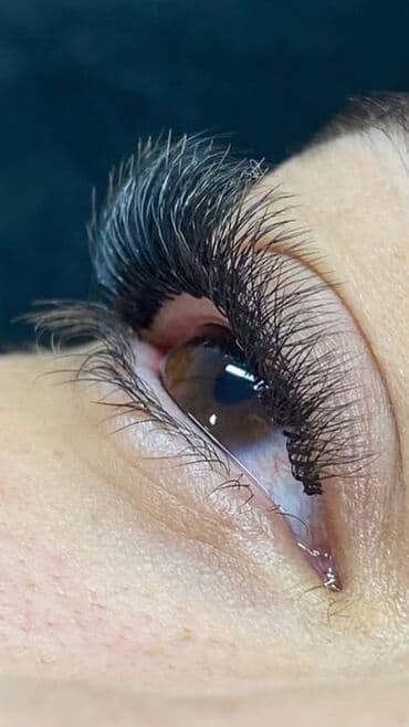 накладные брекеты для красоты купить: Ресницы, Классика, Гипоаллергенные материалы — 2