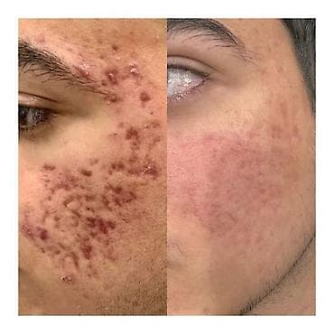 косметолог кант: Косметология, Чистка кожи, Консультация, Требуются модели, Сертифицированный косметолог — 7