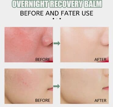 корейские бады день и ночь отзывы: ❄️ США Крем с керамидами антивозрастной увлажняющий Крем с керамидами — 4